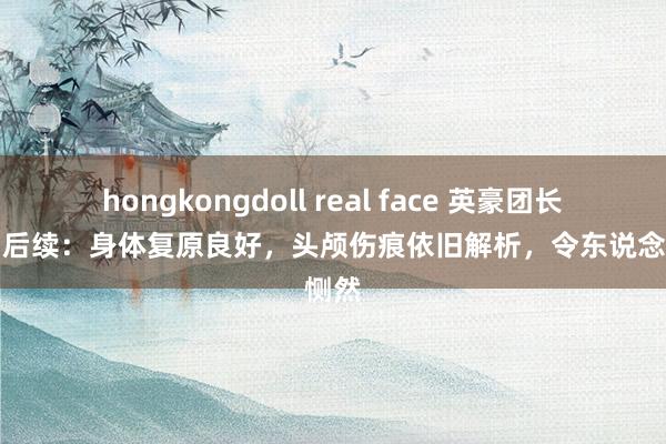 hongkongdoll real face 英豪团长祁发宝后续：身体复原良好，头颅伤痕依旧解析，令东说念主恻然